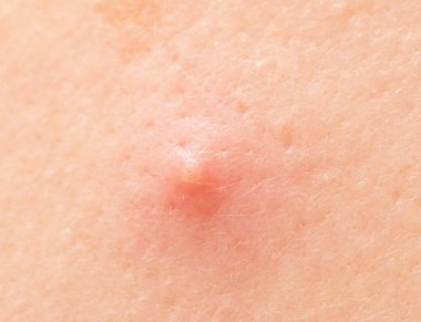 Arka plan olarak yüzdeki yılan balığı