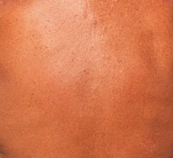 Tanned Back Skin Background — Stock Photo, Image