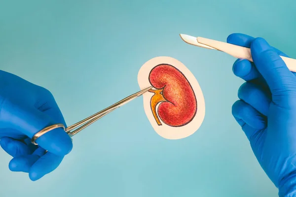 operation on human kidney