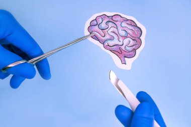 İnsan beyninde acil ameliyat. kalem çizimi.