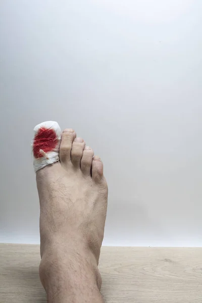 Bandaged big toe, bandaging a part of the body, a tool against the background of injuries