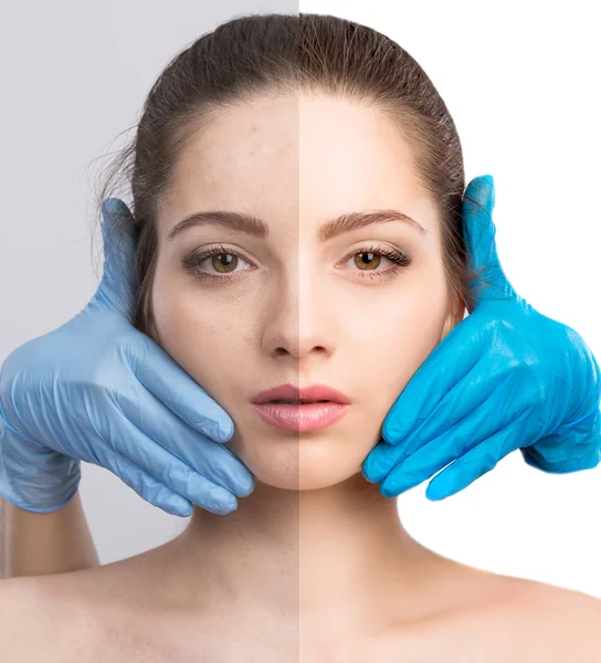  kadın, önce ve sonra rötuş