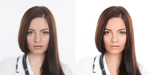  kadın, önce ve sonra rötuş