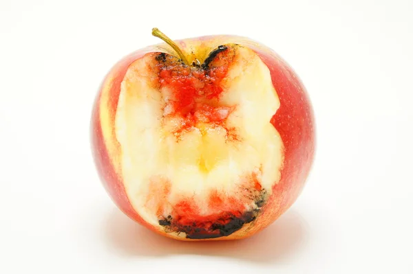 Dişeti iltihabı. Periodontitis.