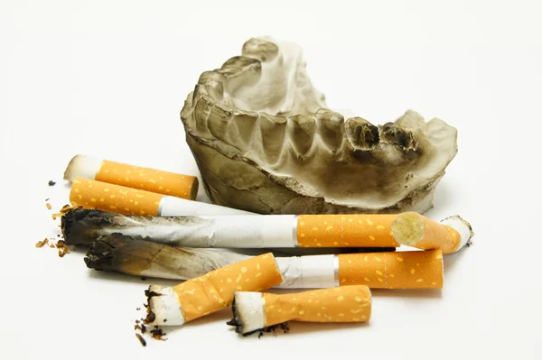 Harm of smoking teeth. — Stock Photo, Image