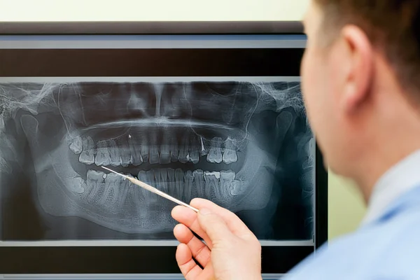 Οδοντιατρική ακτινογραφία — Φωτογραφία Αρχείου