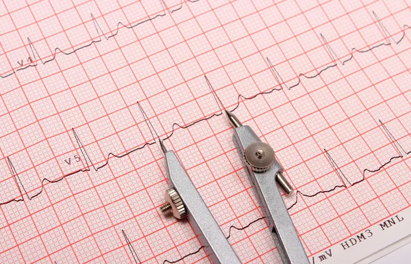 Electrocardiogram graph report and calipers — Stock Photo, Image