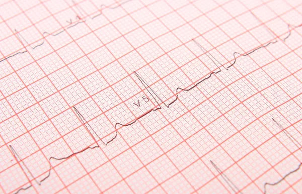 Elektrokardiogram wykres raportu — Zdjęcie stockowe