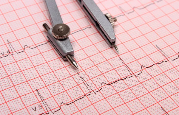 Relatório do eletrocardiograma e paquímetros — Fotografia de Stock