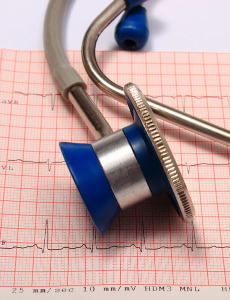 Stetoskop z EKG wykres raportu — Zdjęcie stockowe