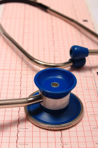Stethoscope with electrocardiogram graph report — Stock Photo, Image