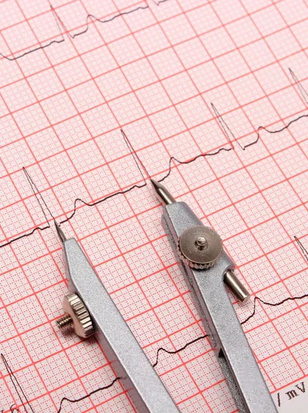 Electrocardiogram graph report and calipers — Stock Photo, Image