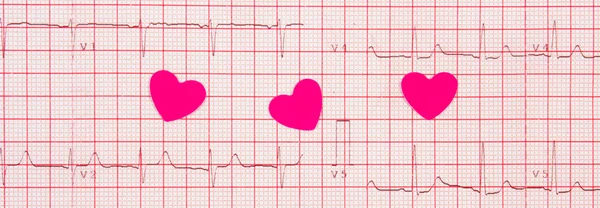 Serca papieru na EKG wykres, medycyny i opieki zdrowotnej koncepcja — Zdjęcie stockowe