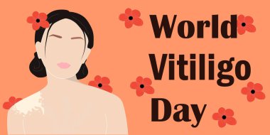 Vitiligo 'lu Çinli kadın portresi. Vitiligo deri hastalığı olan insanlar için destek konsepti. İzole vektör illüstrasyonu.