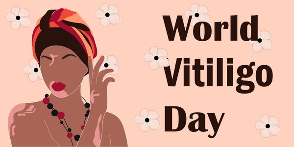 Cartel Del Día Mundial Del Vitiligo Hermosa Mujer Afroamericana Con — Archivo Imágenes Vectoriales