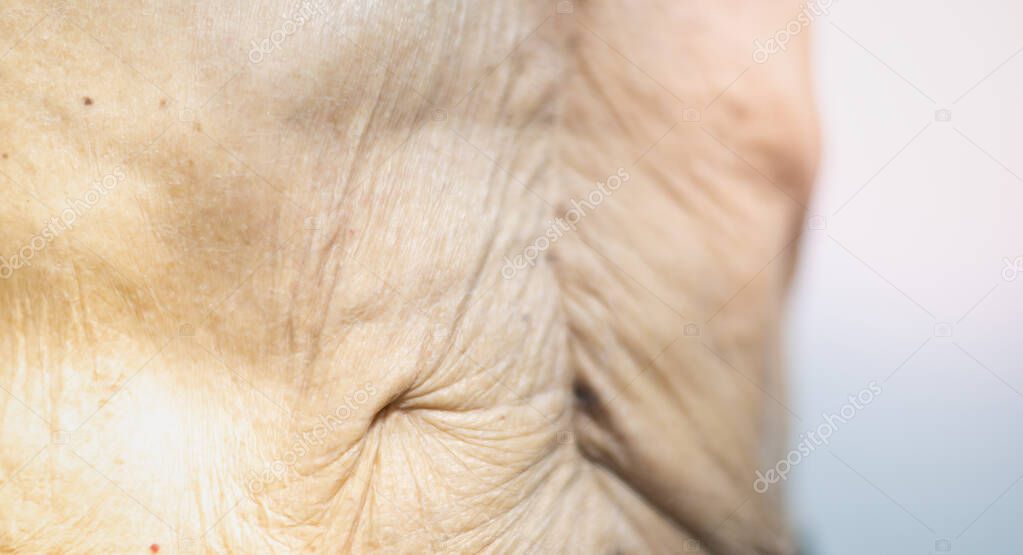 The thin old man skin with close-up old skin with the surgical wound and the wrinkle old skin .