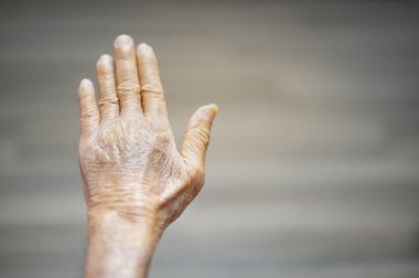 Elleri buruşuk ve besin yetersizliğinden morarmış yaşlı bir adamın eli..