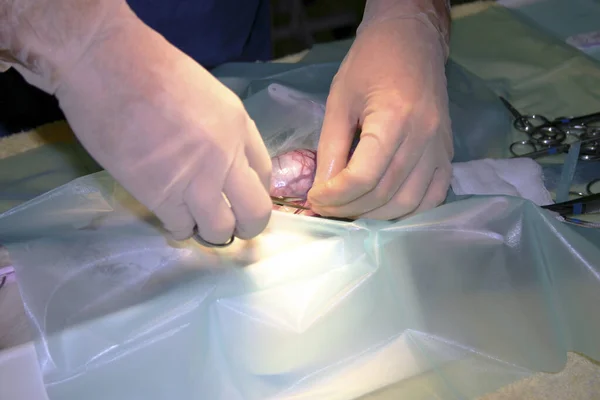 Egy Képzett Sebész Kezei Akik Finom Műtétet Végeznek — Stock Fotó