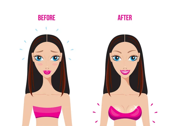 Vector Illustration Breasts before and after Stock Vector