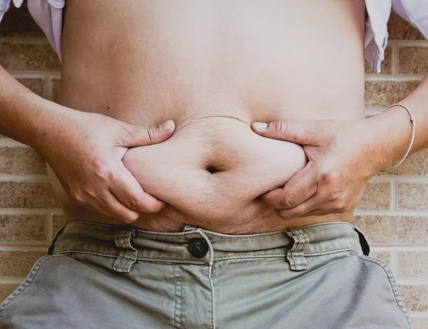 Squeezing belly fat around belly button — Stock Image Squeezing belly fat around belly button Stock Photo