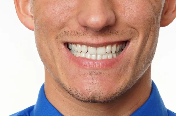 Зубчатая улыбка молодого человека — стоковое фото