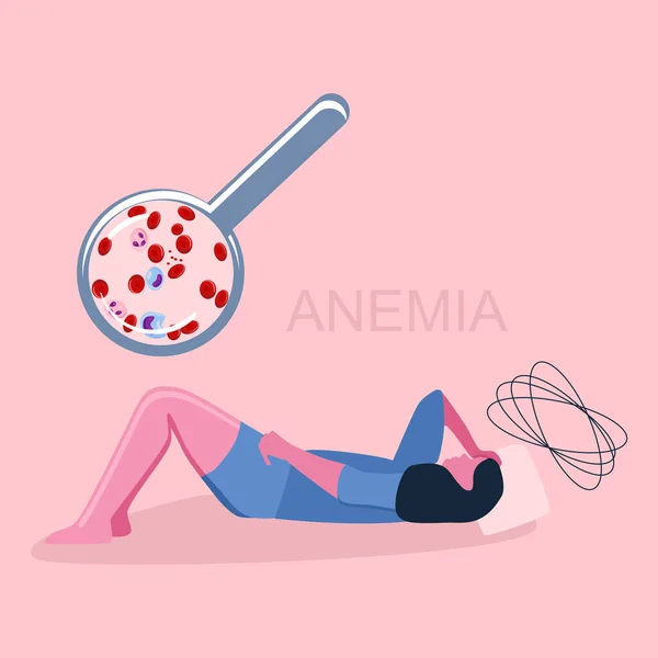Kadın sırt üstü yatıyor ve yorgun, serumdaki demir eksikliği yüzünden zayıf hissediyor. Eritroit veya düşük hemoglobin azalması. Kan analizli büyüteç.