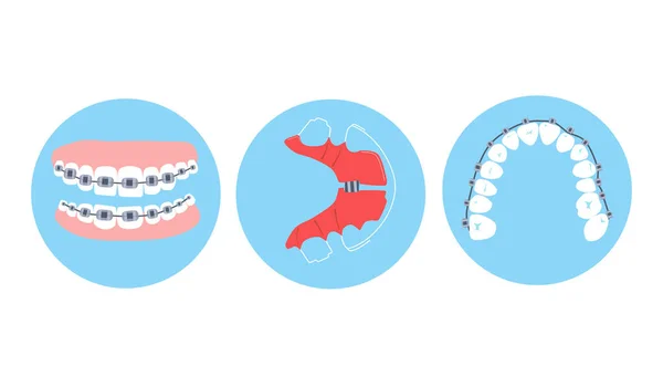 Frenos Dentales Retenedores Metal Alineación Ortodoncia Los Dientes Cuidado Oral — Vector de stock