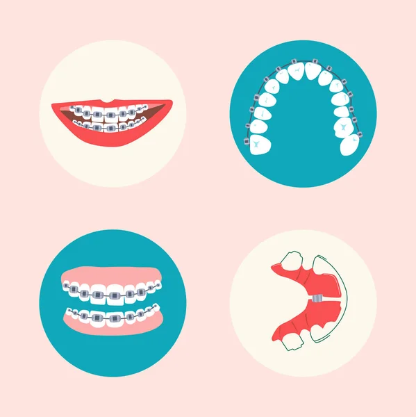 Стоматологические Скобки Выравниватель Ортодонтические Металлические Фиксаторы Зубах Уход Полостью Рта — стоковый вектор