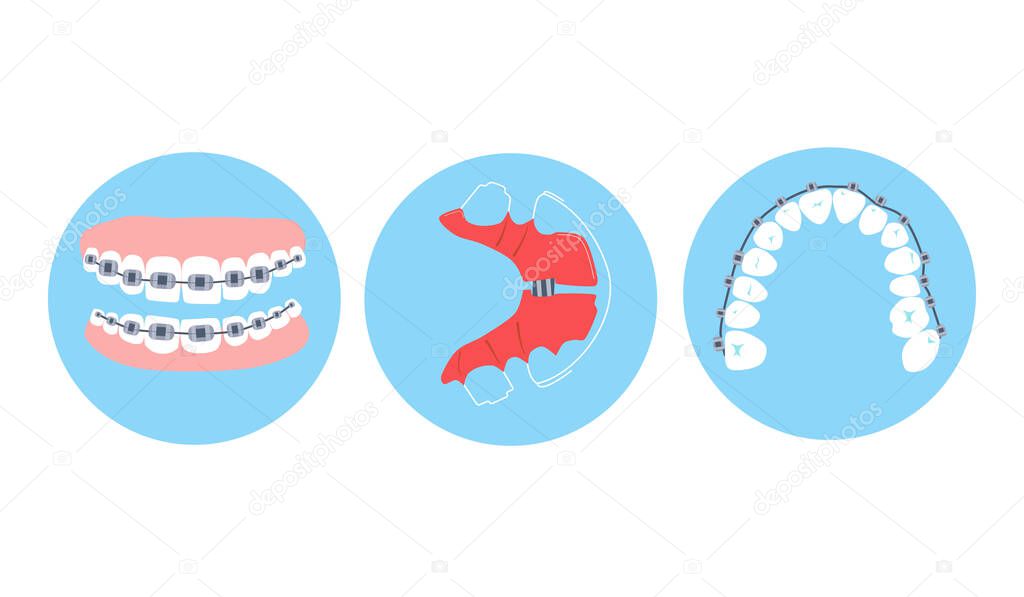 Dental braces, aligner or orthodontic metal retainers on teeth.Oral care and daily routine.Bite correction. Different projections.International day of the dentist.Vector in flat style.Cavity disease