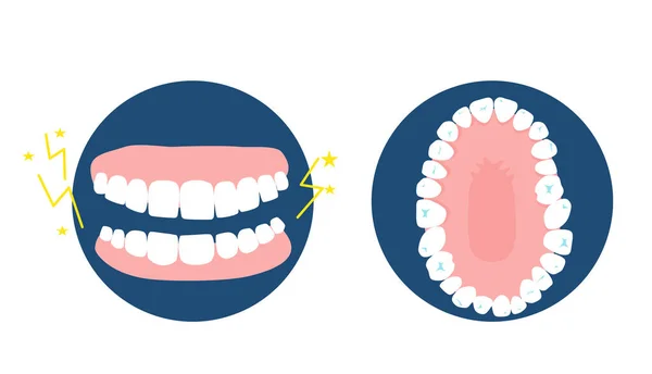 Concepto Enfermedad Bruxismo Vista Superior Frontal Mandíbula Humana Tratamiento Dental — Archivo Imágenes Vectoriales