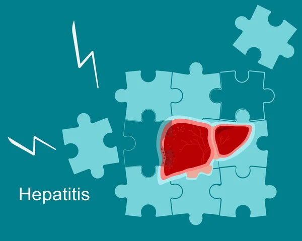 Begreppet Hepatit Cirros Bräcklig Och Bruten Lever Faller Isär Pussel — Stock vektor