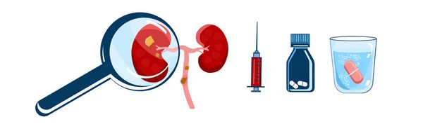 Weltnierentag Horizontal Banner Nephrologie Pyelonephritis Und Niereninsuffizienzkrankheit Menschliches Organ Lupe — Stockvektor