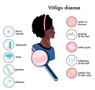 Dünya Vitiligo Günü. Belirtileri ve otoimmün hastalık nedenleri olan bilgi ikonları. Cilt hastalıkları. Beyaz lekeli Afro-Amerikan kadın.