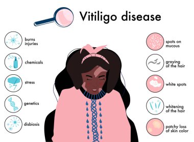 Dünya Vitiligo Günü. Belirtileri ve otoimmün hastalık nedenleri olan bilgi ikonları. Cilt hastalıkları. Beyaz lekeli Afro-Amerikan kadın.