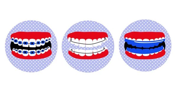 Tandbeugels Essix Uitlijnaar Orthodontische Hawley Beugel Tand Affiche Pop Art — Stockvector