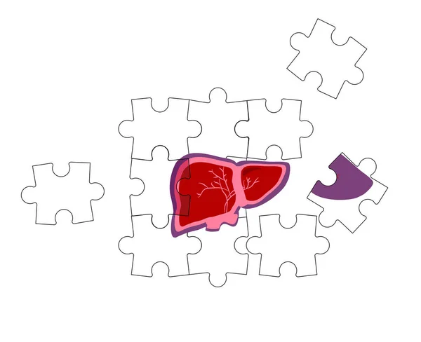 Dia Mundial Hepatite Conceito Cirrose Frágil Fígado Quebrado Desmorona Por — Vetor de Stock