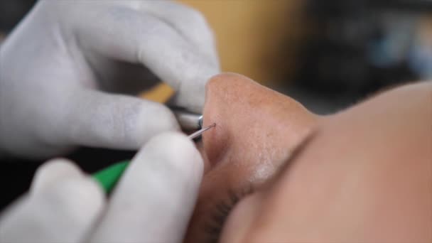 Close-up van de neus piercing proces — Stockvideo