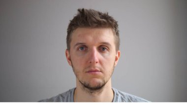 Üzücü Stresli Mutsuz Adam Kameraya Bakıyor. Stres, Depresyon Konsepti.