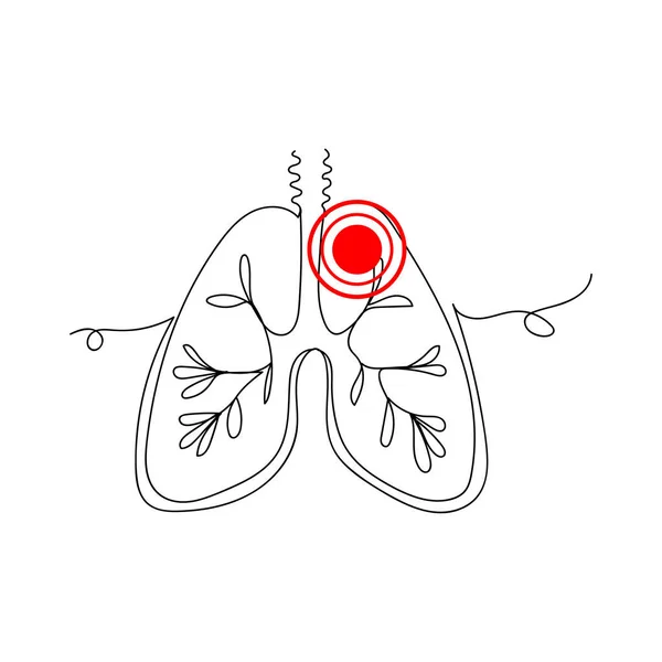 肺炎のベクター アイコン喘息 １本の線画 ベクターイラスト連続線画 — ストックベクタ