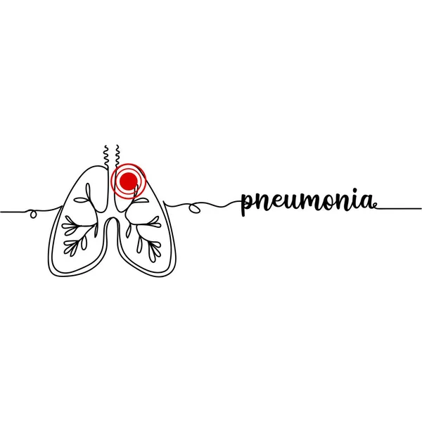 肺炎の連続的な1行の描画シルエット 病気の概念 白い背景に独立したベクターイラスト — ストックベクタ