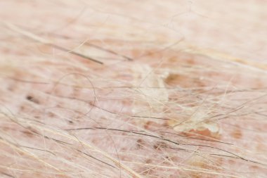 Makro köpek kürk ve dermatit deri