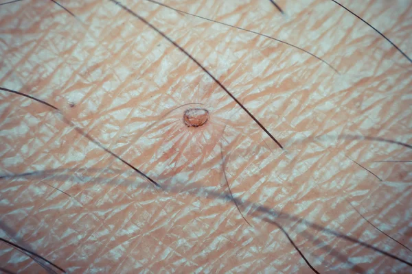 Макро сухой кожи азия человека — стоковое фото