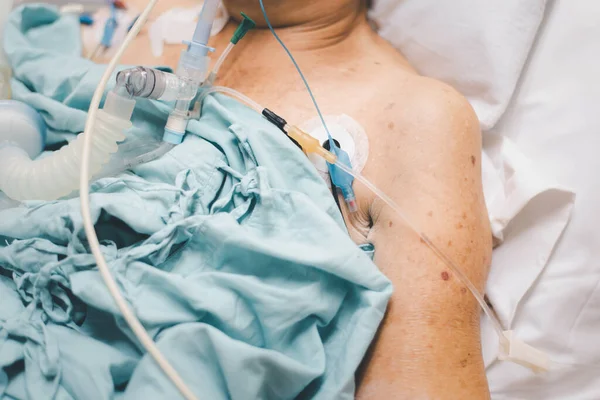 80歳以上のアジア系高齢女性80歳以上のインフルエンザ コビド19は 集中治療室 Icu の患者のベッドで呼吸支援のために人工呼吸器を使用します 病院のコンセプトヘルスケア室で — ストック写真