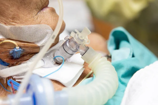 在重症监护病房 亚洲老年妇女80多岁的流感患者在病床上使用呼吸机帮助呼吸 Icu 医院病房在概念保健生活中的作用 — 图库照片