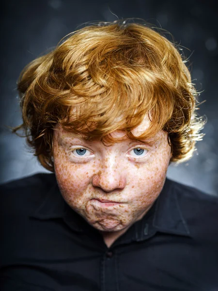 Fat freckled boy portrait — Stock Photo, Image