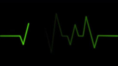 Dinamik Yeşil Elektrokardiyogram Hattı Karanlık Ekranda Titreşen, Yaşamsal Yaşam İşaretlerini temsil eden, Tıbbi Sağlık İzleme ve Gelişmiş Teşhis Teknolojisi
