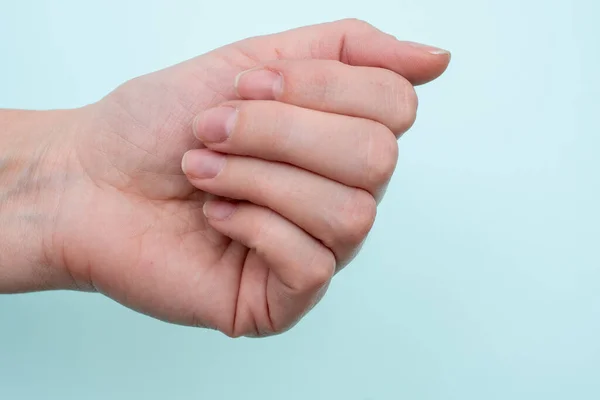 Koncepcja Naturalnych Paznokci Surowych Paznokci Zbliżenie Białej Żeńskiej Dłoni Naturalnymi — Zdjęcie stockowe