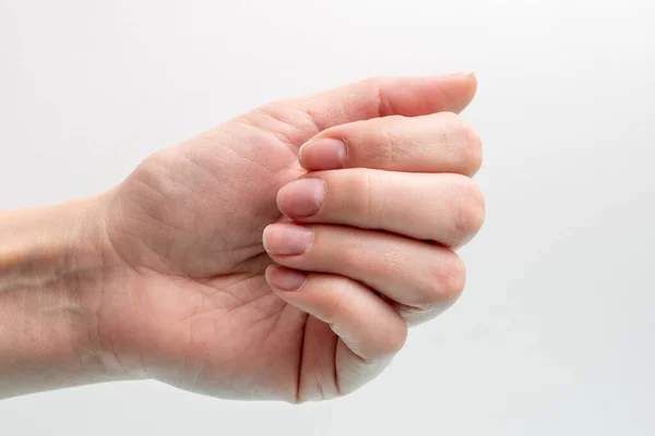 Close Van Een Blanke Vrouwelijke Hand Met Natuurlijke Ongepolijste Nagels — Stockfoto
