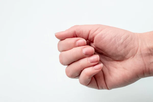 Concepto Para Uñas Naturales Uñas Crudas Primer Plano Mano Femenina — Foto de Stock