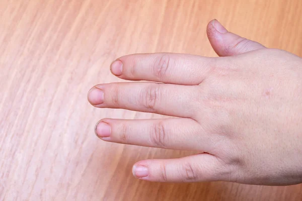 Nahaufnahme Der Weiblichen Hand Mit Natürlichen Rohen Schmutzigen Nägeln Auf — Stockfoto